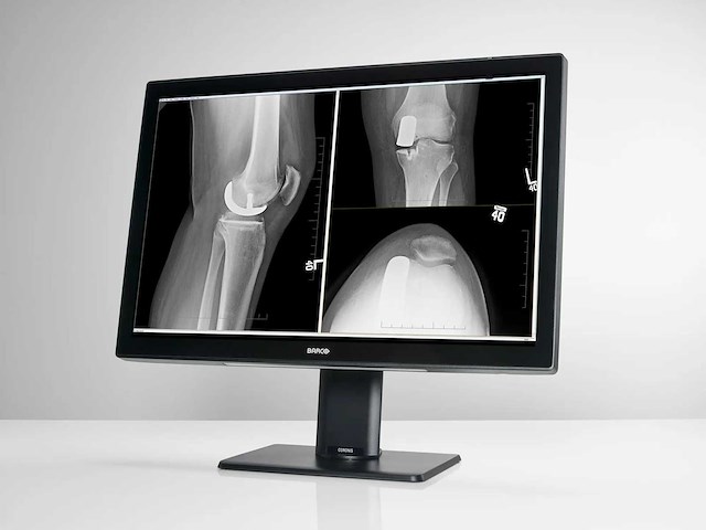 Barco mdcc-4130 medische monitor - afbeelding 2 van  6