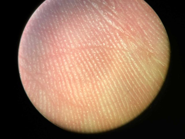 Carl zeiss - opmi6-sdfcxy - operatie microscoop - afbeelding 5 van  10