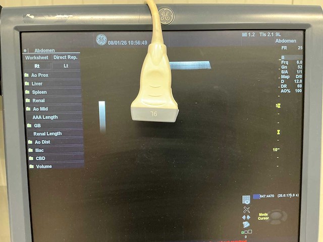 Echo apparaat - ge healthcare - logiq e9 - 2010 - afbeelding 6 van  7