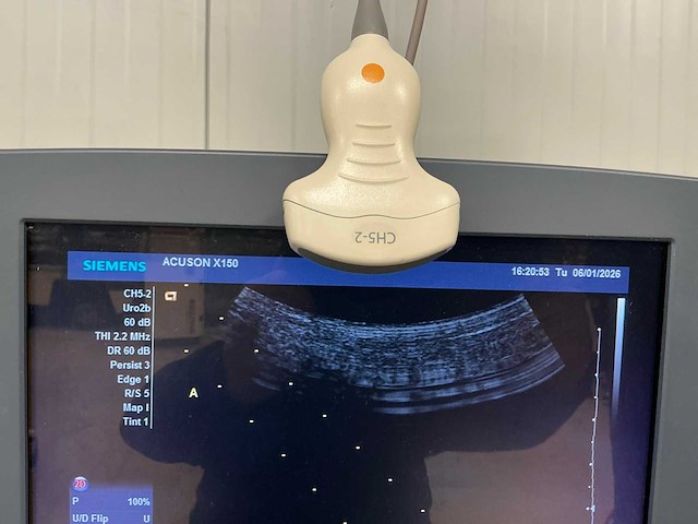Echo apparaat - siemens - acuson x150 - 2011 - afbeelding 6 van  8