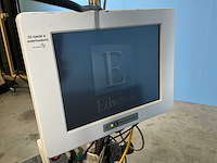 Edwards lifescience ev1000 patiëntmonitor - afbeelding 2 van  11