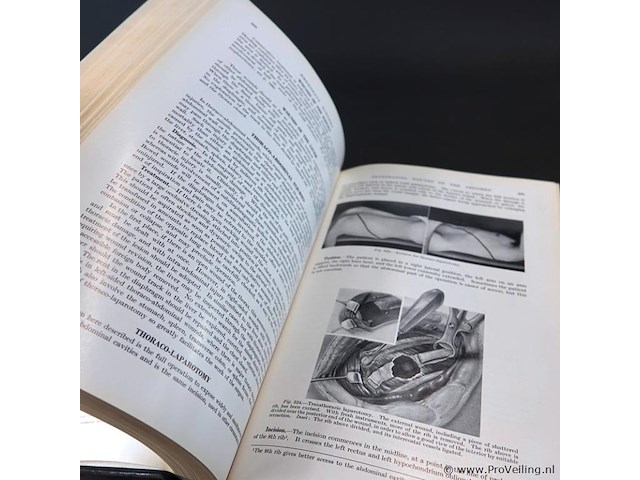 Emergencu surgery - afbeelding 4 van  5