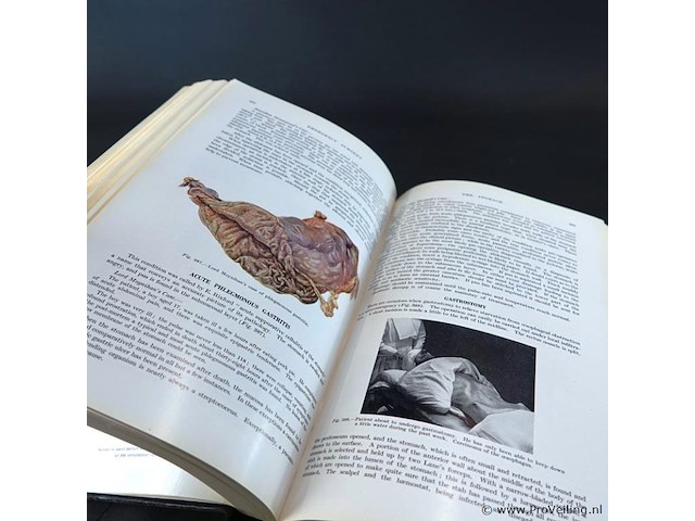 Emergencu surgery - afbeelding 5 van  5