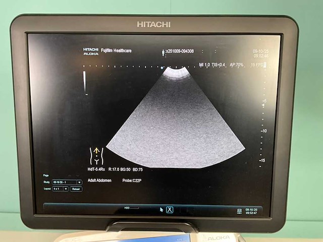 Hitachi - arietta v70 - echo-apparaat - 2016 - afbeelding 10 van  17