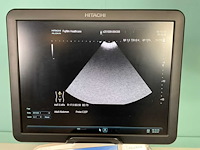 Hitachi - arietta v70 - echo-apparaat - 2016 - afbeelding 10 van  17