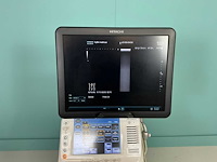 Hitachi - arietta v70 - echo-apparaat - 2016 - afbeelding 3 van  17