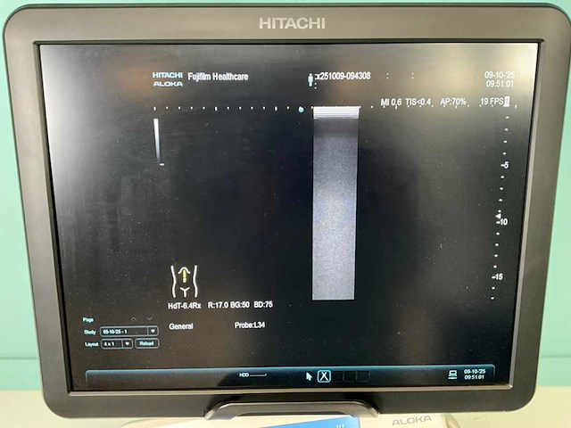 Hitachi - arietta v70 - echo-apparaat - 2016 - afbeelding 11 van  17