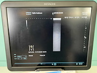 Hitachi - arietta v70 - echo-apparaat - 2016 - afbeelding 11 van  17