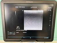 Hitachi - arietta v70 - echo-apparaat - 2016 - afbeelding 13 van  17