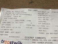 Hose clamp (4x) - afbeelding 3 van  3