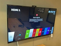 Lg 65uk6300plb televisie - afbeelding 3 van  6