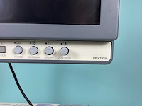 Olympus wm-np1 endoscopiekarretje met monitor - afbeelding 3 van  8