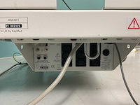 Olympus wm-np1 endoscopiekarretje met monitor - afbeelding 8 van  8