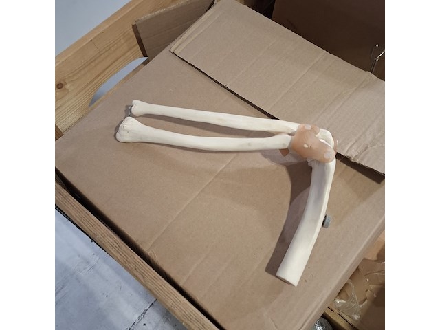 Partij functie modellen kniegewricht - afbeelding 4 van  5