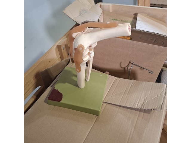 Partij functie modellen kniegewricht - afbeelding 5 van  5