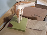 Partij functie modellen kniegewricht - afbeelding 5 van  5