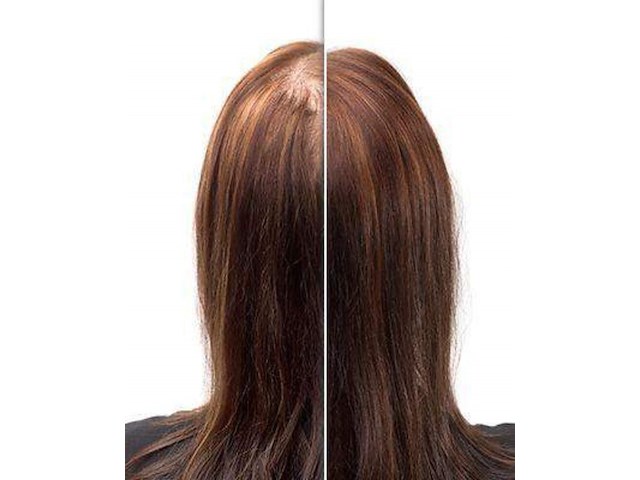 Partij haargroei cosmetica - circa 25 pallets re-hair - afbeelding 5 van  16