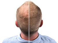 Partij haargroei cosmetica - circa 25 pallets re-hair - afbeelding 6 van  16