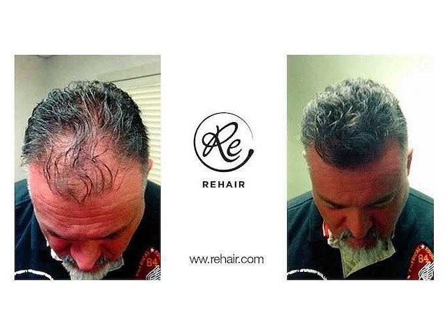 Partij rehair haargroei producten - afbeelding 15 van  29