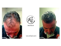 Partij rehair haargroei producten - afbeelding 15 van  29