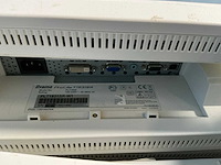 Patiëntmonitor (12x) - afbeelding 6 van  7