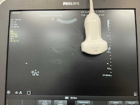 Philips - clearvue 550 - echo apparaat - afbeelding 7 van  8