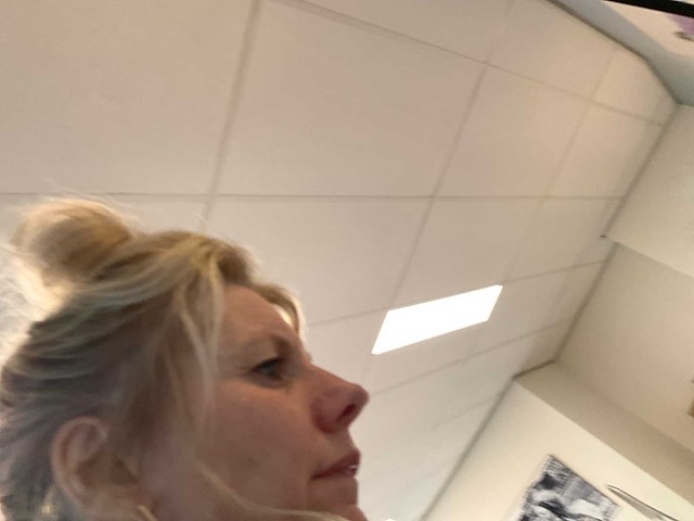 Sht cristalpeel machine - afbeelding 4 van  6