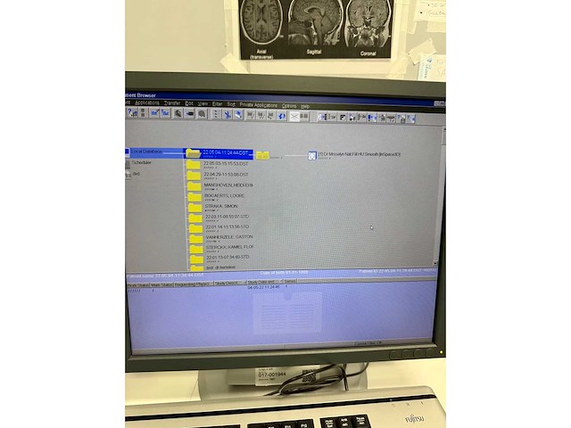 Siemens - artis zeego - robotic angiography system - 2010 - afbeelding 6 van  178
