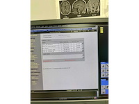 Siemens - artis zeego - robotic angiography system - 2010 - afbeelding 13 van  178