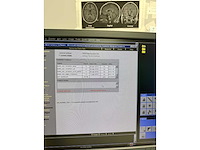 Siemens - artis zeego - robotic angiography system - 2010 - afbeelding 14 van  178