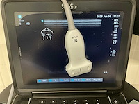 Sonosite - 2021 - p21775-20-b - echo apparaat - afbeelding 3 van  8