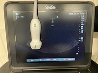 Sonosite - 2021 - p21775-20-b - echo apparaat - afbeelding 7 van  8