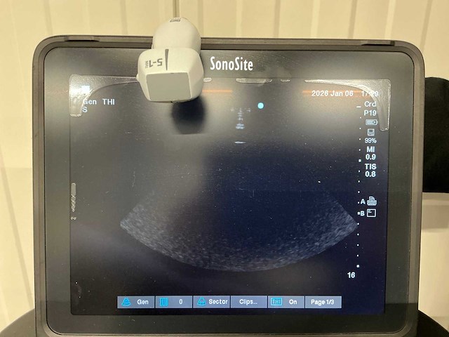Sonosite - 2021 - p21775-20-b - echo apparaat - afbeelding 8 van  8