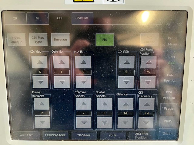 Toshiba - aplio mx (ssa-780a) - ultrasound machine - 2010 - afbeelding 3 van  28