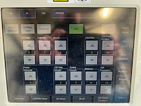 Toshiba - aplio mx (ssa-780a) - ultrasound machine - 2010 - afbeelding 3 van  28