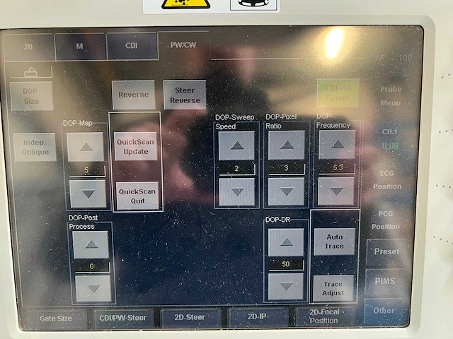 Toshiba - aplio mx (ssa-780a) - ultrasound machine - 2010 - afbeelding 4 van  28