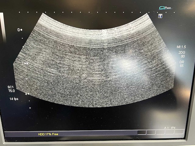Toshiba - aplio mx (ssa-780a) - ultrasound machine - 2010 - afbeelding 8 van  28