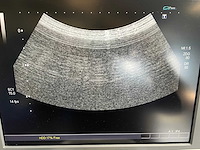Toshiba - aplio mx (ssa-780a) - ultrasound machine - 2010 - afbeelding 8 van  28