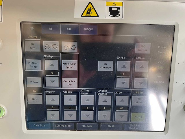 Toshiba - aplio mx (ssa-780a) - ultrasound machine - 2010 - afbeelding 9 van  28