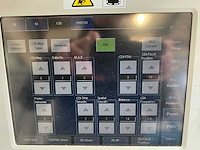 Toshiba - aplio mx (ssa-780a) - ultrasound machine - 2010 - afbeelding 11 van  28