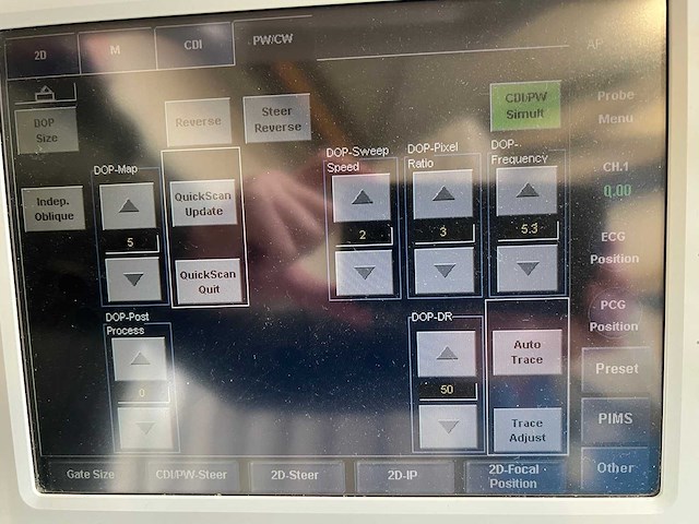 Toshiba - aplio mx (ssa-780a) - ultrasound machine - 2010 - afbeelding 13 van  28