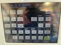 Toshiba - aplio mx (ssa-780a) - ultrasound machine - 2010 - afbeelding 18 van  28