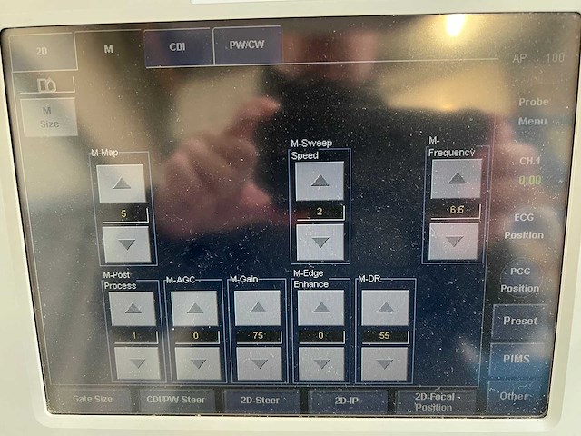 Toshiba - aplio mx (ssa-780a) - ultrasound machine - 2010 - afbeelding 19 van  28