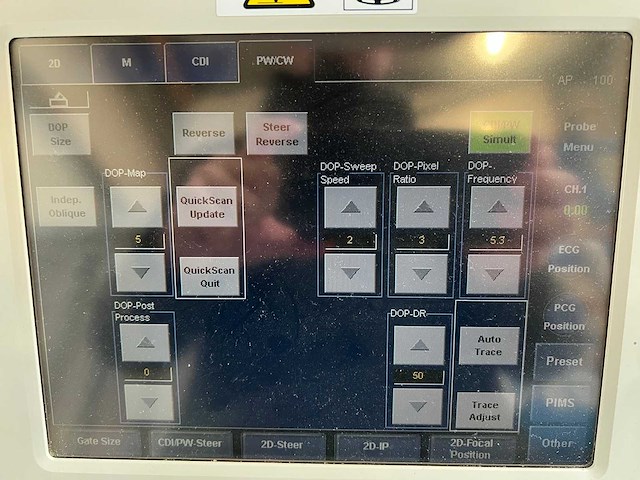 Toshiba - aplio mx (ssa-780a) - ultrasound machine - 2010 - afbeelding 21 van  28