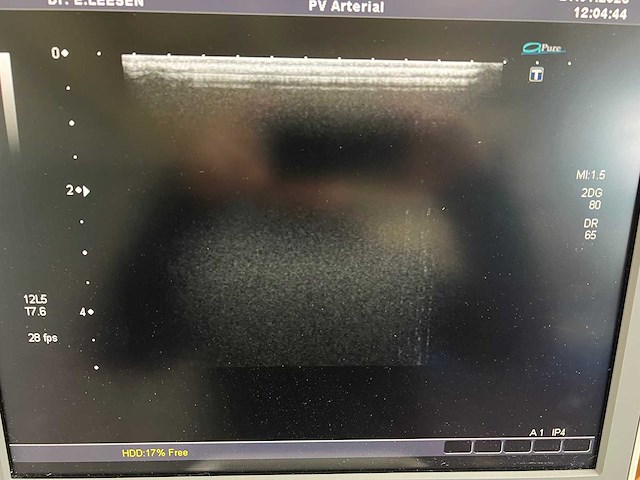 Toshiba - aplio mx (ssa-780a) - ultrasound machine - 2010 - afbeelding 27 van  28