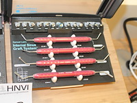 Twee sinuskraft systems megagen lateral en internal. - afbeelding 3 van  3