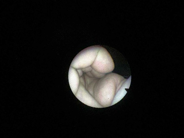 Vision sciences - cst-4000 - fiber cystoscoop met draagbare lichtbron bls-1000 - afbeelding 4 van  7