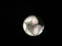 Vision sciences - cst-4000 - fiber cystoscoop met draagbare lichtbron bls-1000 - afbeelding 4 van  7