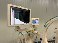 Ziehm - solo - röntgenapparaat - afbeelding 3 van  8